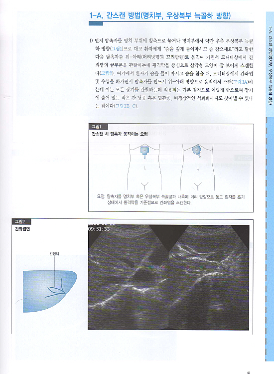 초음파 영상진단 : 개원의와 수련의를 위한(복부.갑상선.경동맥.골절)