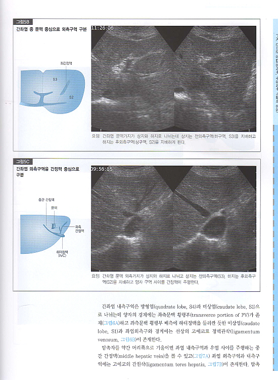 초음파 영상진단 : 개원의와 수련의를 위한(복부.갑상선.경동맥.골절)