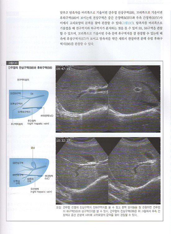 초음파 영상진단 : 개원의와 수련의를 위한(복부.갑상선.경동맥.골절)