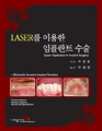 LASER를 이용한 임플란트 수술(Laser Application In Implant Surgery)