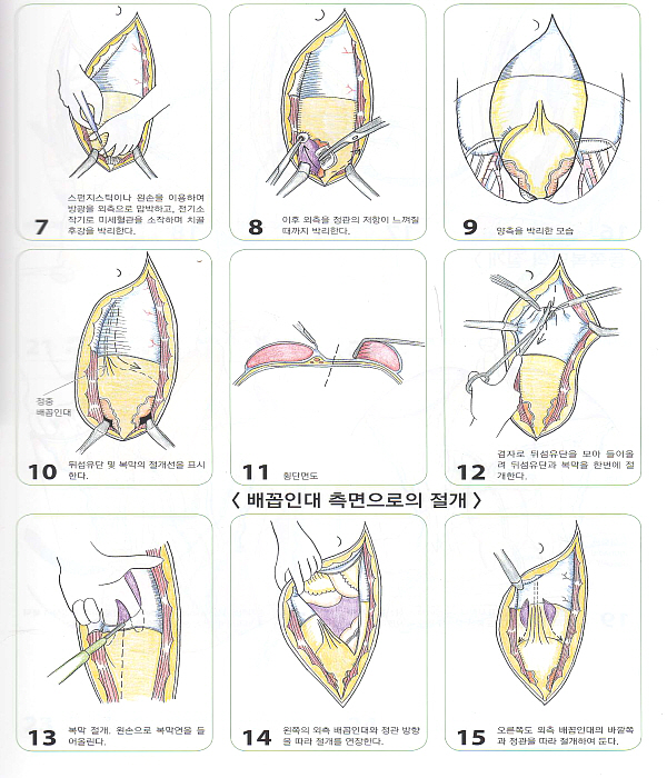 원색그림으로 보는 실전 비뇨기과 수술