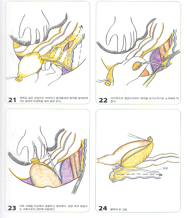 원색그림으로 보는 실전 비뇨기과 수술