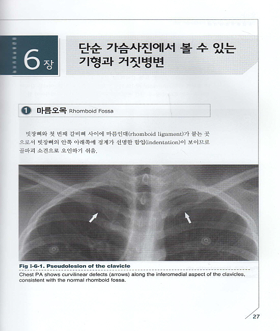 응급흉부영상의학