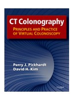 CT Colonography: Principles & Practice of Virtual Colonoscopy