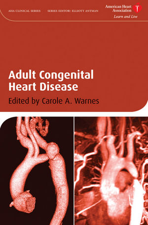 Adult Congenital Heart Disease - Wiley