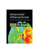 Intracranial Atherosclerosis