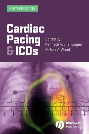 Cardiac Pacing and ICDs, 5th Edition