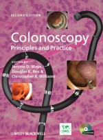 Colonoscopy: Principles and Practice, 2nd Edition