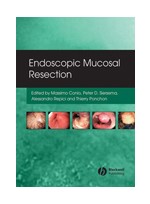 Endoscopic Mucosal Resection