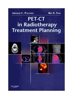 PET-CT in Radiotherapy Treatment Planning