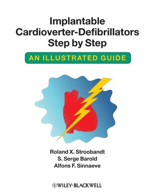 Implantable Cardioverter - Defibrillators Step by Step: An Illustrated Guide