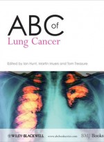 ABC of Lung Cancer