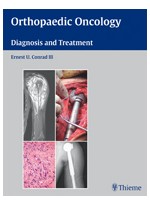 Orthopaedic Oncology (Diagnosis and Treatment)