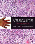 Vasculitis,2/e