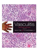 Vasculitis,2/e