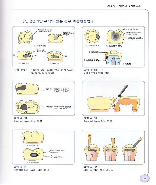 임상 소아치과학 아틀라스 - 개정판 -