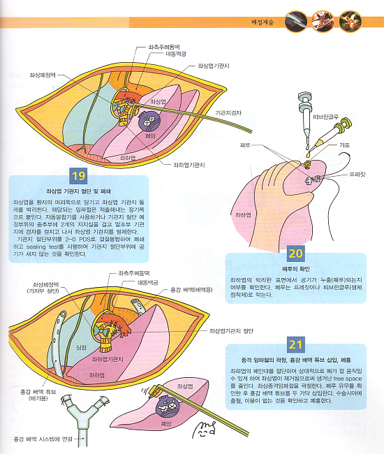 만화로 보는 수술과 처치-2편