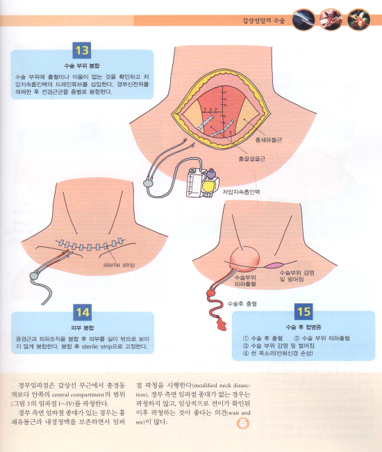 만화로 보는 수술과 처치-2편