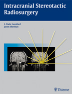 Intracranial Stereotactic Radiosurgery