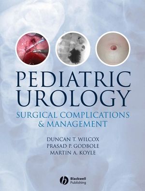 Pediatric Urology: Surgical Complications and Management