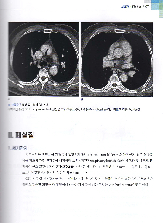 흉부영상진단CT