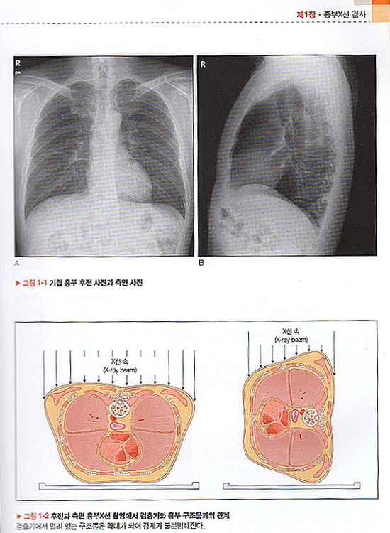 흉부영상진단X선