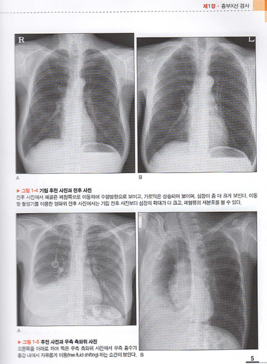 흉부영상진단X선