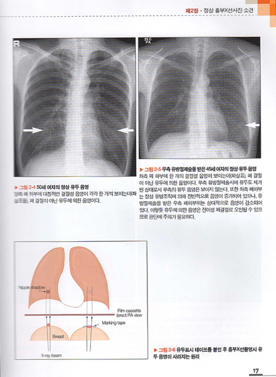 흉부영상진단X선