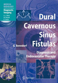 Dural Cavernous Sinus Fistulas: Diagnosis & Endovascular Therapy