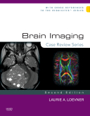 Brain Imaging(Case Review), 2/e