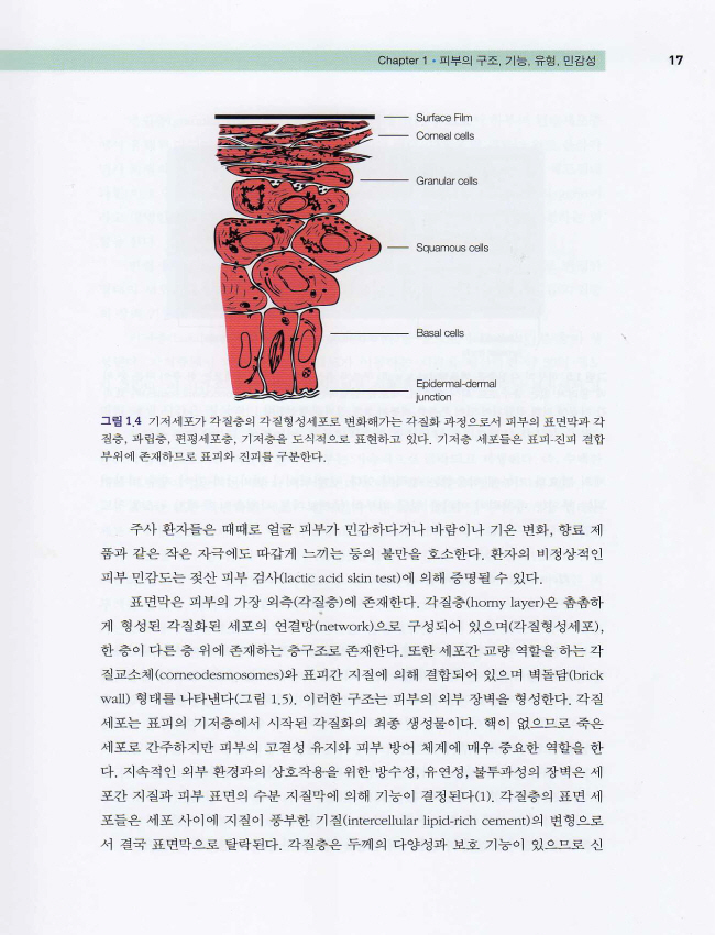 주사(딸기코)의 진단과 치료 - Rosacea