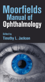 Moorfields Manual of Ophthalmology