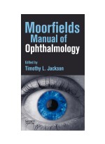 Moorfields Manual of Ophthalmology