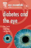 Eye Essentials: Diabetes and the Eye