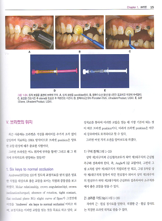 多 알려주는 교정치료의 임상