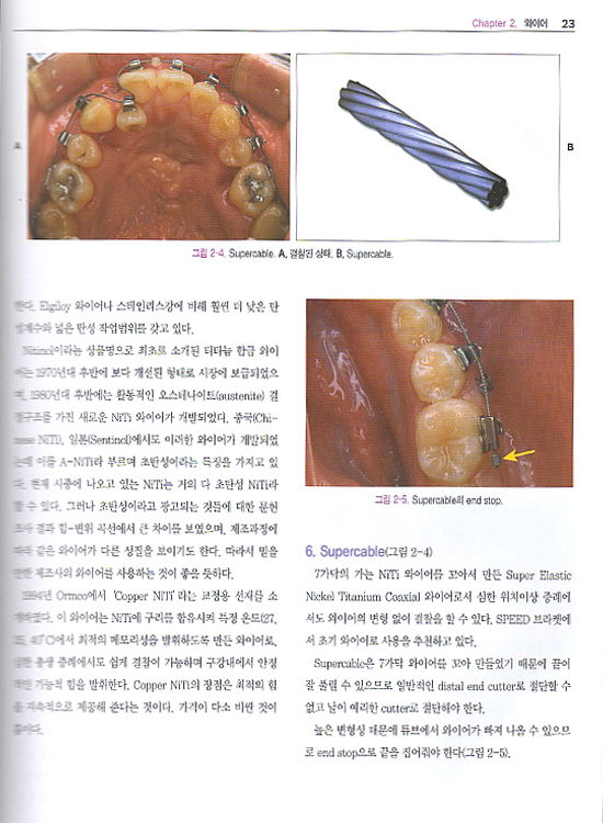 多 알려주는 교정치료의 임상