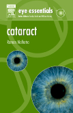 Eye Essentials: Cataract