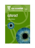 Eye Essentials: Cataract