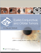 Eyelid Conjunctival & Orbital Tumors & Intraocular Tumors,2/e(2Vols)