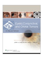 Eyelid Conjunctival & Orbital Tumors & Intraocular Tumors,2/e(2Vols)