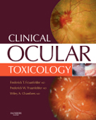 Clinical Ocular Toxicology