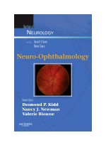 Neuro-Ophthalmology Blue Books of Neurology Series, Vol, 32