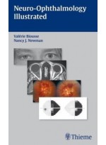 Neuro-Ophthalmology Illustrated