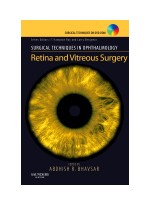 Surgical Techniques in Ophthalmology Series: Retina and Vitreous Surgery