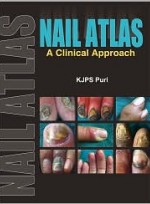 Nail Atlas: A Clinical Approach