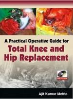 A Practical Operative Guide for Total Knee and Hip Replace