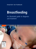 Breastfeeding - An Atlas of Diagnosis and Treatment