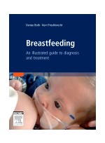 Breastfeeding - An Atlas of Diagnosis and Treatment
