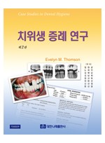 치위생증례연구 제2판