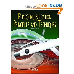 Phacoemulsification: Principles and Techniques (Hardcover)